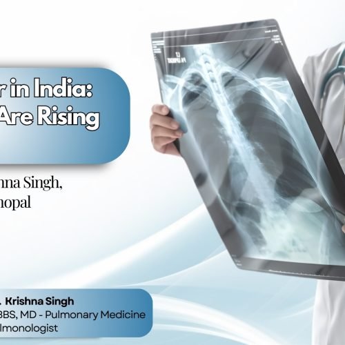 Lung cancer awareness illustration showing affected lungs for early diagnosis and treatment