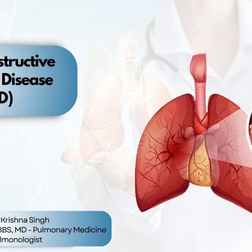 A pulmonologist stands next to a medical illustration of lungs affected by Chronic Obstructive Pulmonary Disease (COPD), showing airway inflammation, with a highlighted title and credentials.
