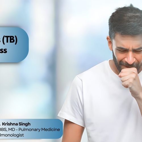 Patient showing cough symptoms for Tuberculosis awareness with pulmonologist Dr. Krishna Singh highlighting TB diagnosis and treatment care