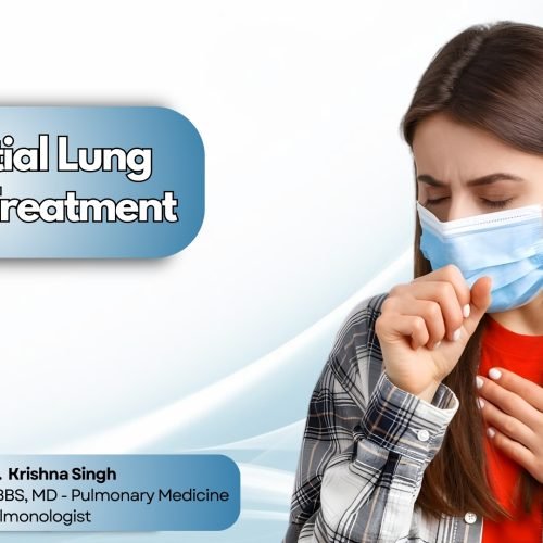 Woman wearing mask coughing due to interstitial lung disease, representing Interstitial Lung Disease Treatment in Bhopal by Dr. Krishna Singh.